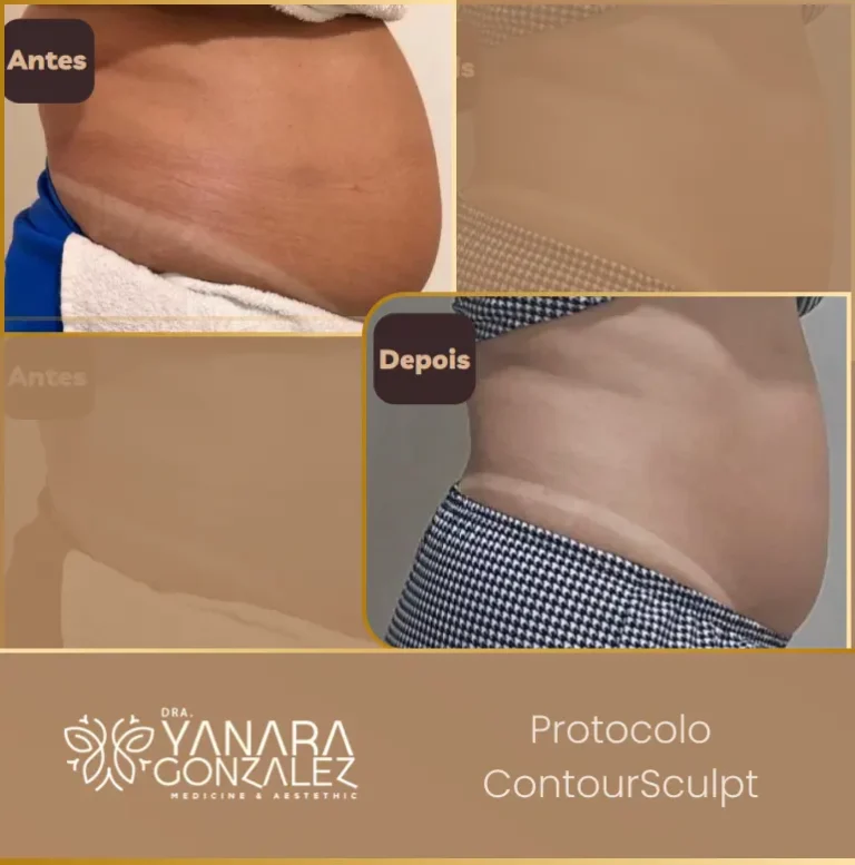 YG - antes e depois 5